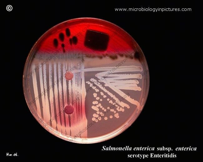 growth of salmonella on Endo agar with biochemical slope